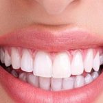 Maxillofacial Prosthetics