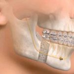 Oral And Maxillofacial Surgery